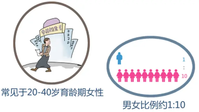 东方美女病是系统性红斑狼疮 育龄期患者备孕得守这几道关