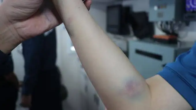 中菲海警碰撞后 菲律宾紧急换将中方后手曝光